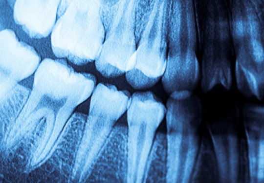 DIGITAL X-RAYS Technology Image