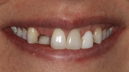 Dr. Farahani before image