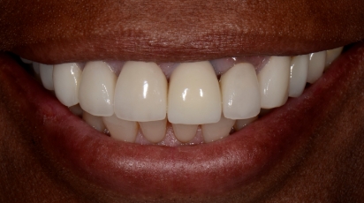 Dr. Farahani before image