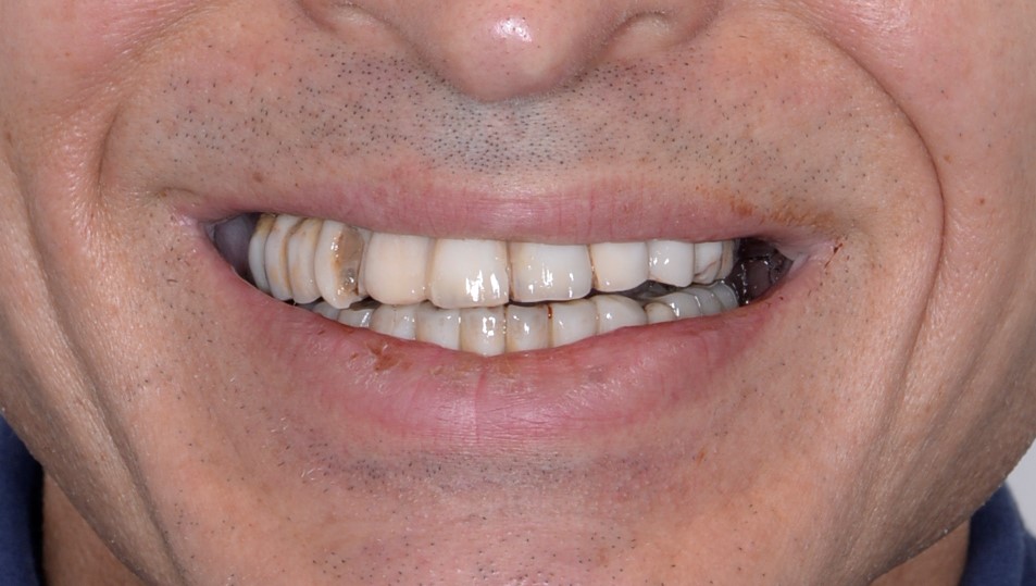 Dr. Farahani before image