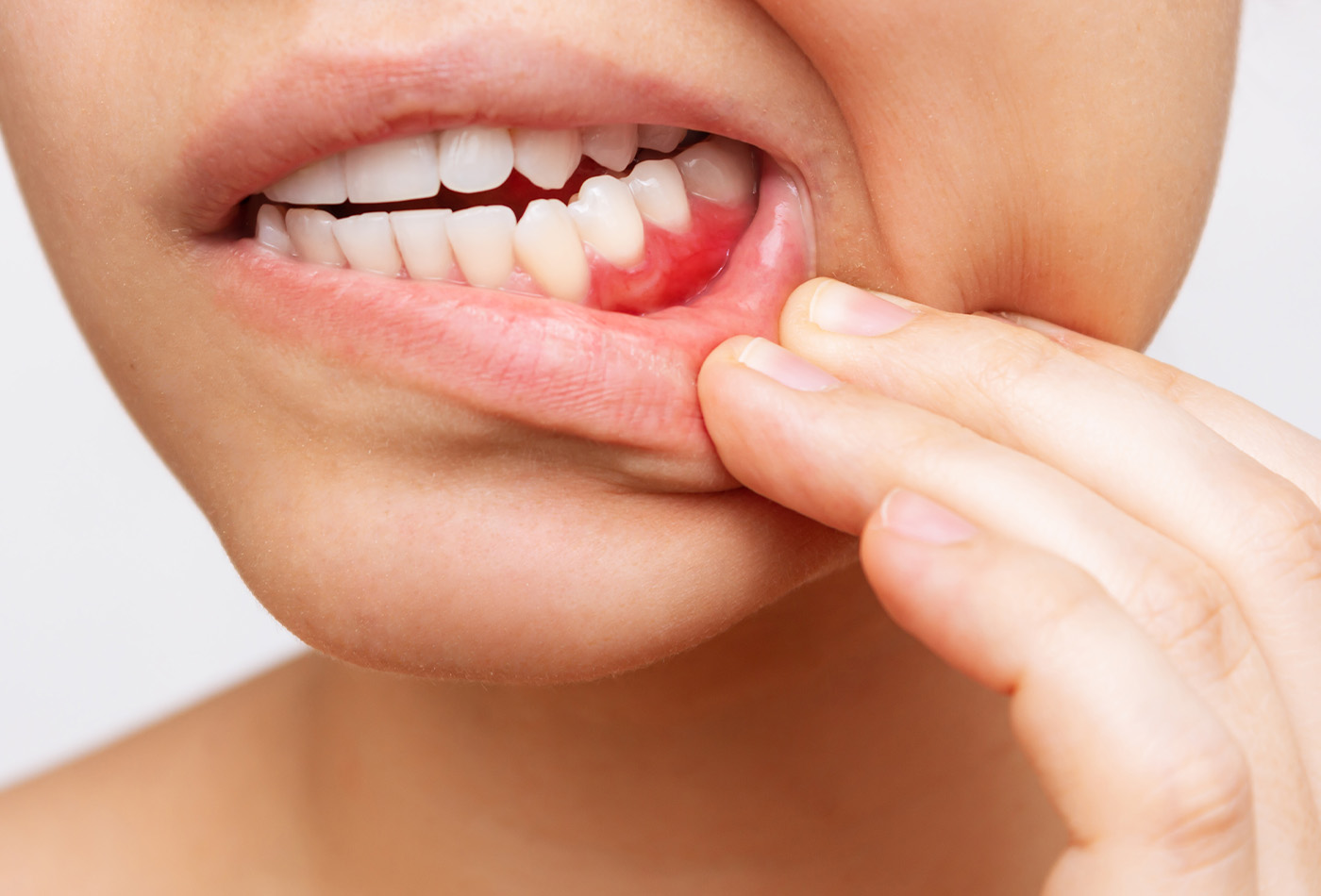 What Are The Most Common Dental Diseases?