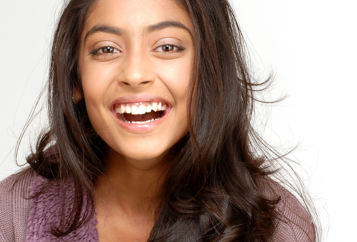 Teeth Whitening vs Bleaching: 10 Key Differences & 10 FAQs